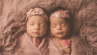 Babyfoto, Neugeborenenfotografie, Stefanie Baars, Hamburg